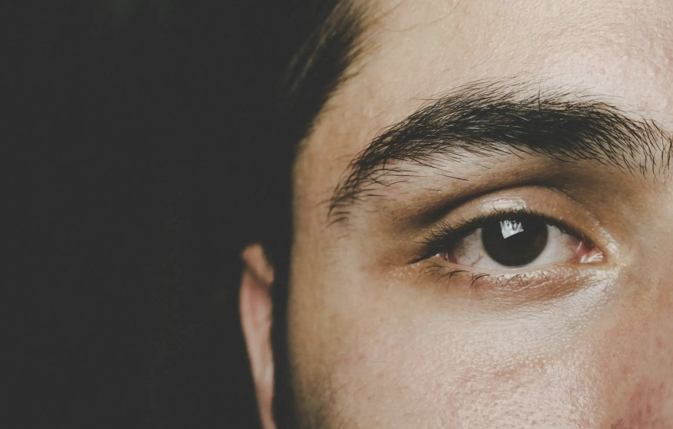 hormone responsible for hyperpigmentation
