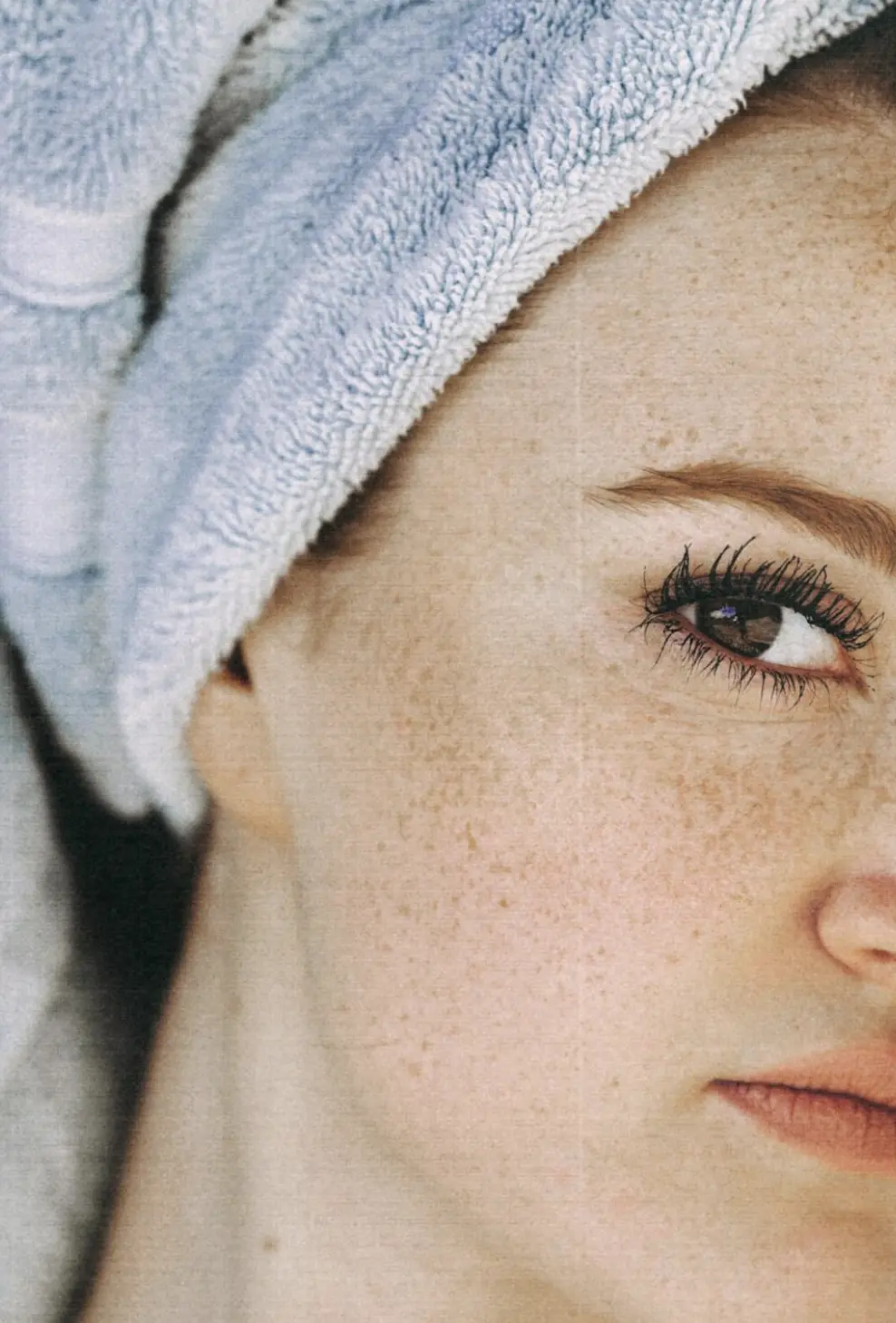 what triggers melanin production hormonally